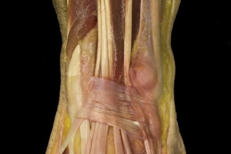 Muscular antebrazo