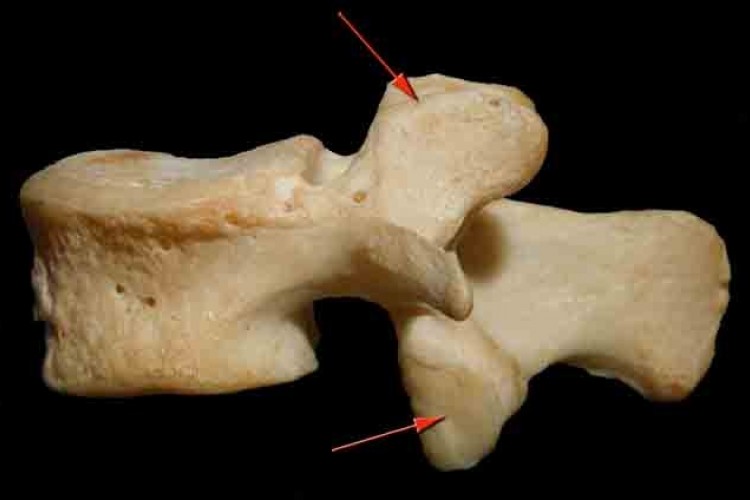 Apófisis articular vertebral