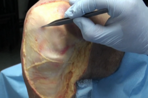Human atlas anatomy by dissection videos