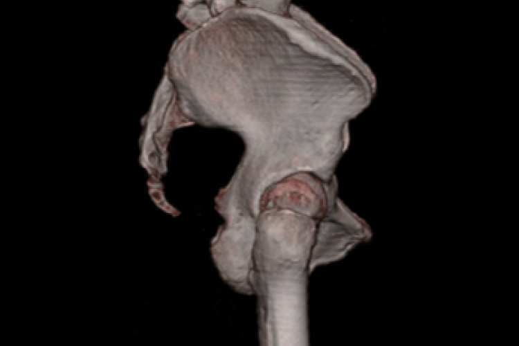 Visión lateral derecha 3D pelvis