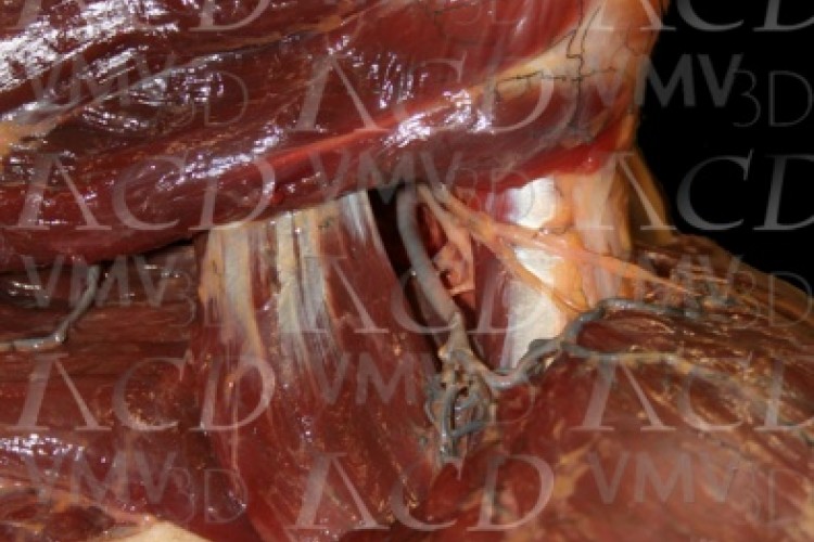 Nervio axilar y arteria circunfleja humeral posterior.