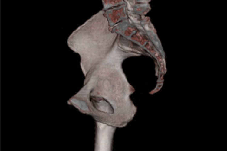 Visión medial derecha 3D pelvis ósea