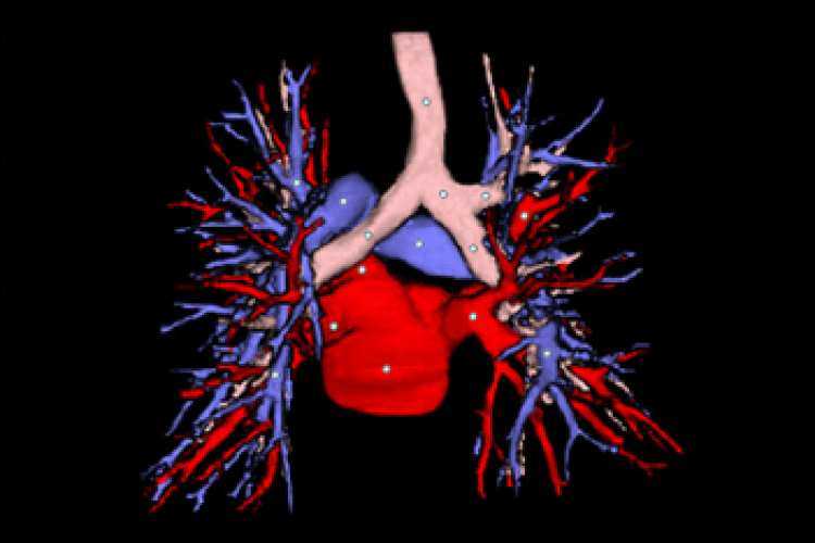 Visión posterior TC 3D vasos pulmonares